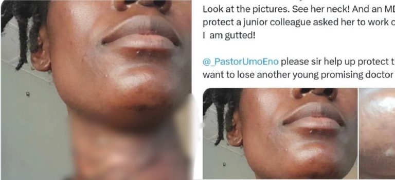 Nigerian doctor seeks urgent help as a junior doctor who was almost k!lled in an attack, allegedly forced back to work the next day by her boss