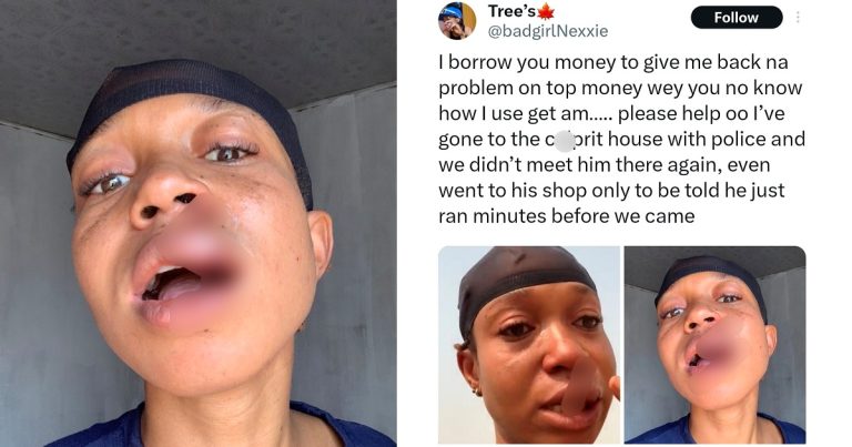 "In this life, don't help anybody" – Woman says as she warns those who offer assistance to others, after her debtor bruta.lized and fled with her money (Video)