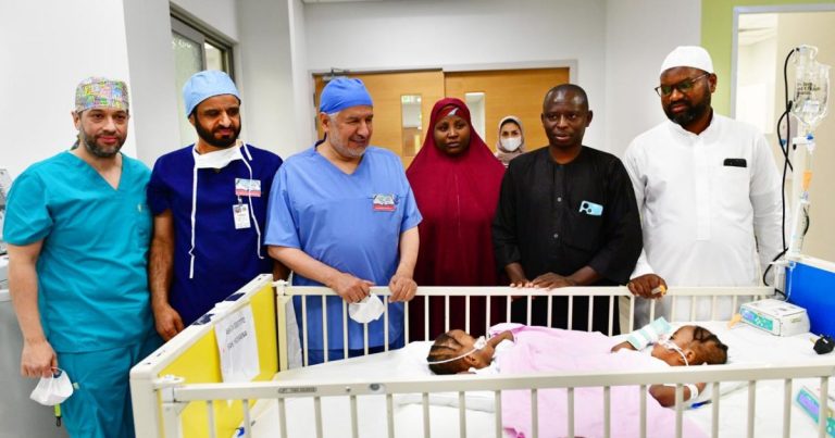 Saudi medical team separates Kano conjoined twins