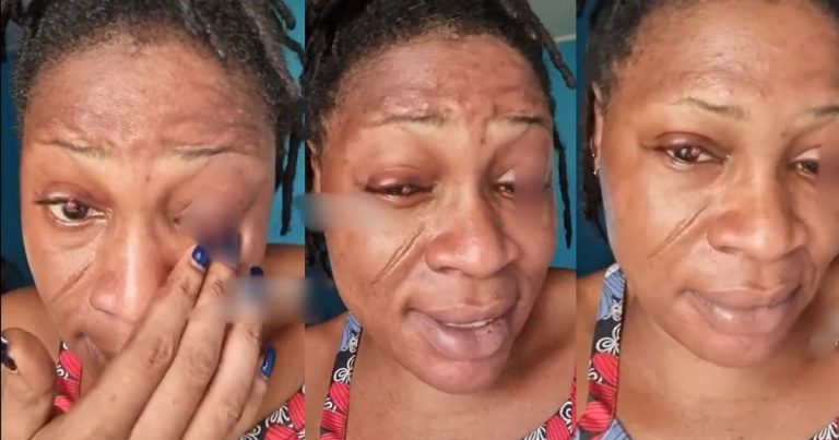 "To get belle come dey fear person" - Netizens React As Woman Shares How Pregnancy Affected Her Eyes (VIDEO)