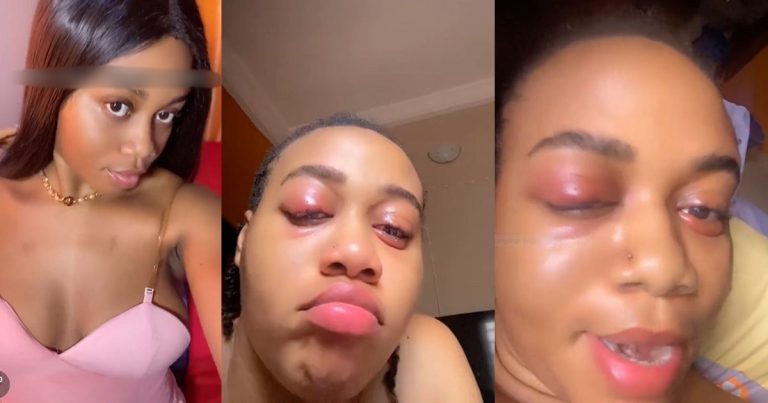 "You sure say na heat or hit" – Stunning Nigerian Lady's Allergic Reaction To Heat Stuns Online Users (VIDEO)