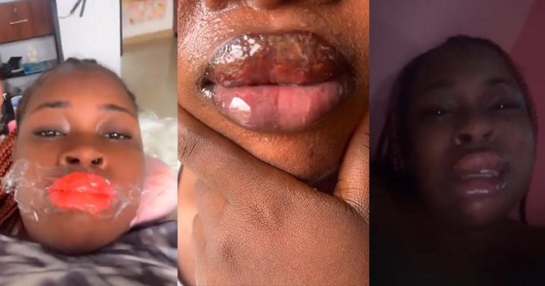 "God gave you natural lips, Now You go blush am" - Reactions As Nigerian Woman's Lip Blushing Procedures Leaves Her In Te.ars (VIDEO)