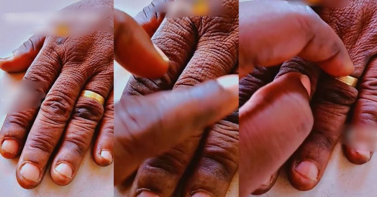 Mixed Reactions As Nigerian Woman's Mother Wears Her Wedding Ring For 48 Years Straight (VIDEO)