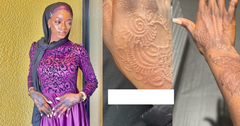 Nigerian lady with sensitive skin got permanent tattoo after getting a Henna (WATCH)