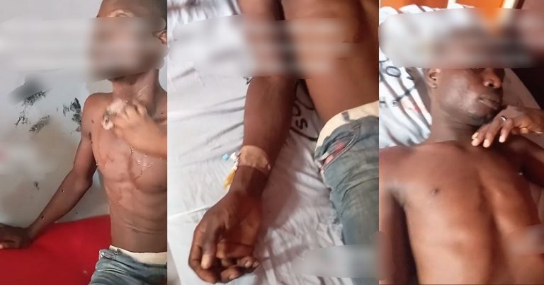 Nigerian Man Hospitalized After Drinking Cement To Evade Debt, Faces ₦60k Medical Bill (WATCH)