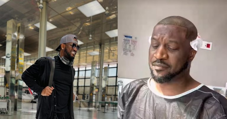 Peter Okoye undergoes hair transplant in Turkey (WATCH)