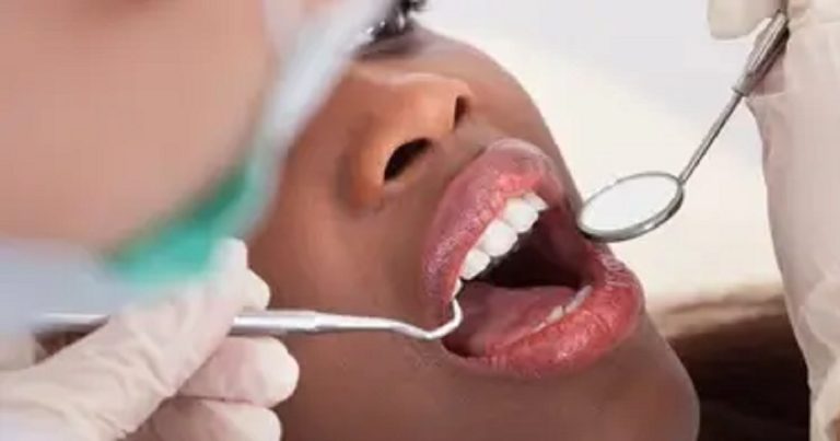 "He said if it’s pr££k now you’ll open properly" – Lady shares what a male surgeon at LUTH said to her while she strugglǝd to open her mouth during dental surgǝry