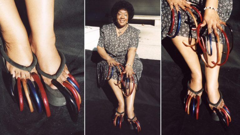 Woman with world’s longest toenails, Louise Hollis, dies at 86