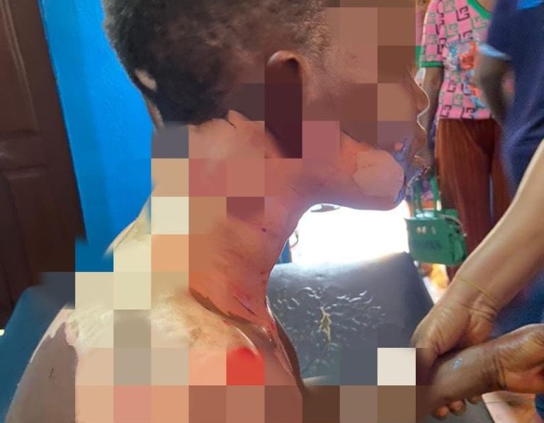 Police arrest husband for pouring hot oil on wife in Ogun