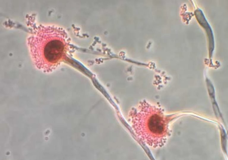 Fungi that can ‘eat you from the inside out’ could spread as world heats up — Scientists