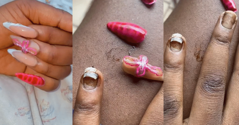 Lady F0rcefully Removes Month-Old Artificial Nails, Claims Nail Tech Used ‘Iron Gum’ (WATCH) Lady F0rcefully Removes Month-Old Artificial Nails, Claims Nail Tech Used 'Iron Gum' (WATCH)