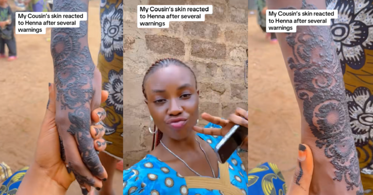 "Same thing happened to her last year, but she has a  strong head" – Lady reveals her cousin's skin reacted to Henna despite several warnings (VIDEO)
