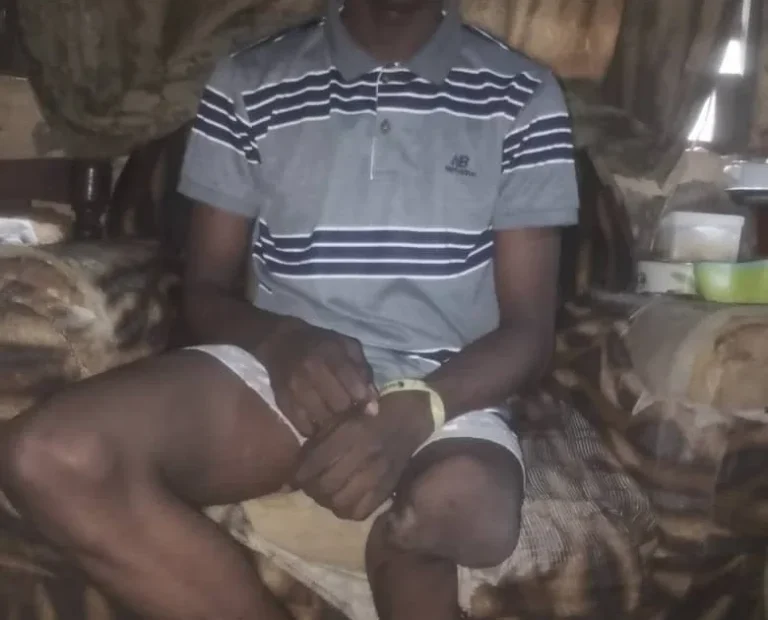 17-year-old seeks N2m for leg amputation, artificial limb