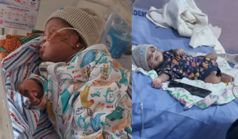 Family seeks N17m financial assistance for three-month-old's heart surgery