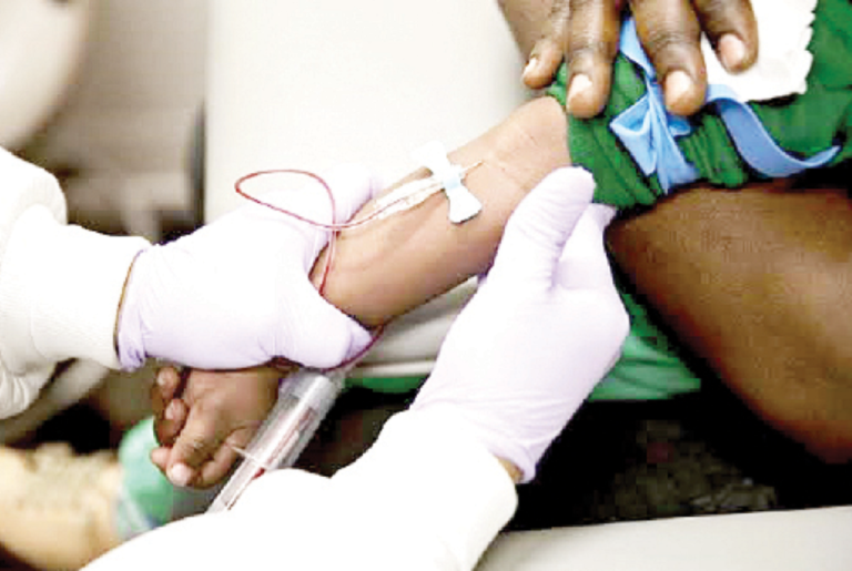 Sickle cell trait may hide diabetes, Ghana study warns hope for sickle cell patients