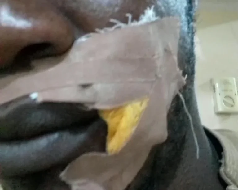 ADC supporter injured in Edo gun attack