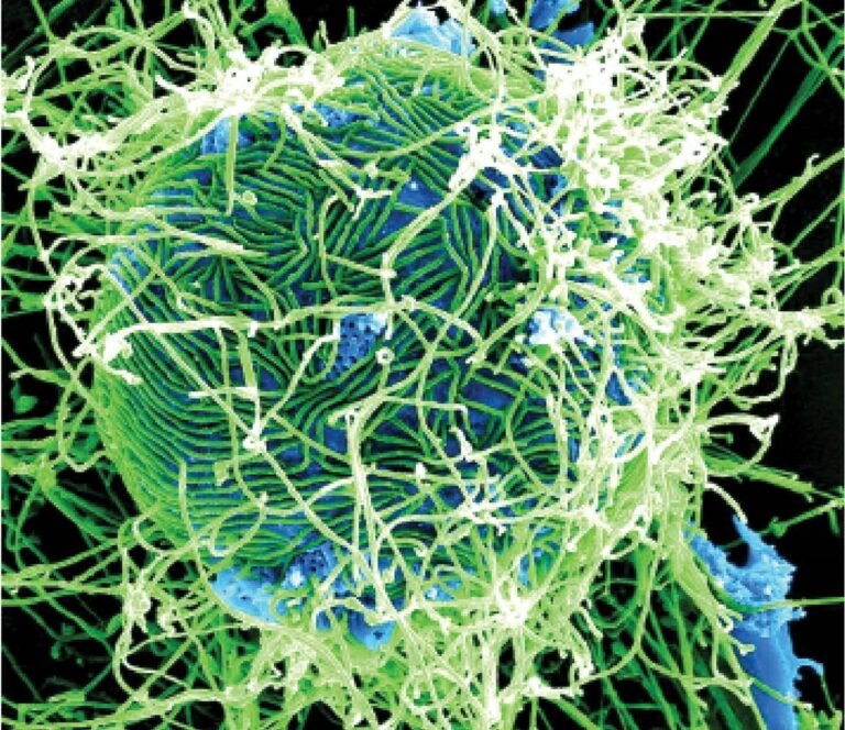 on the Ebola